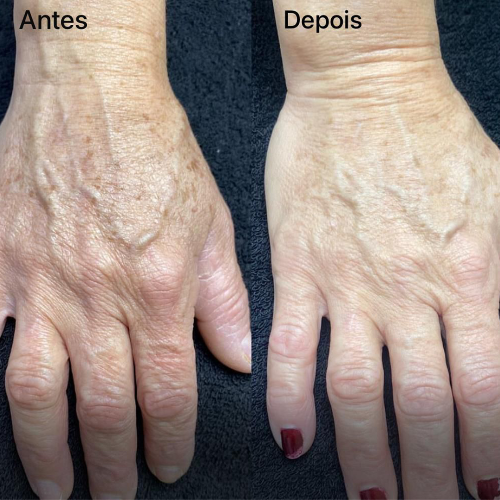 AD1 - 10anos