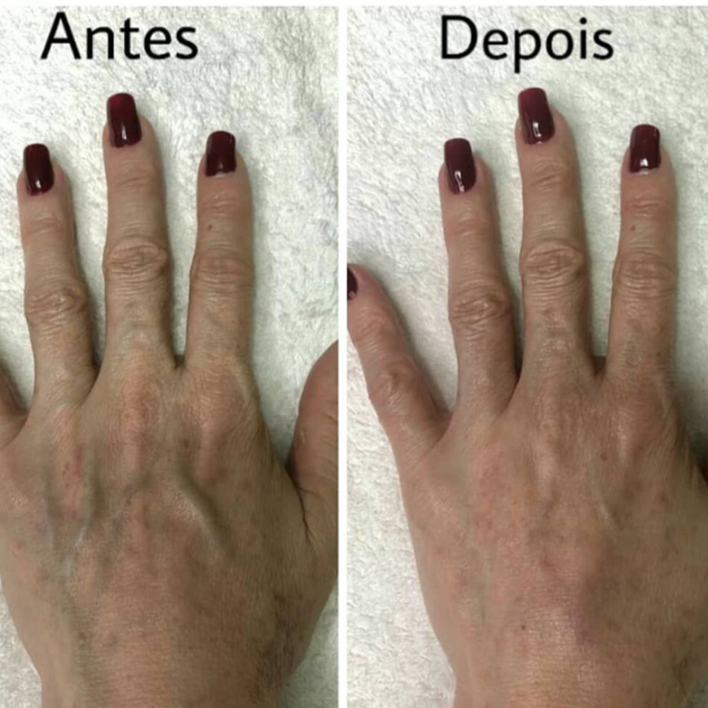 AD2 - 10anos